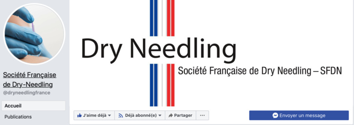 Société Française de dry-needling